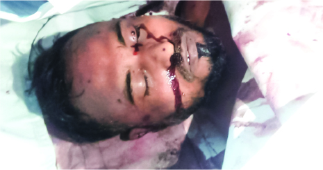 Image of মো: শিমুল